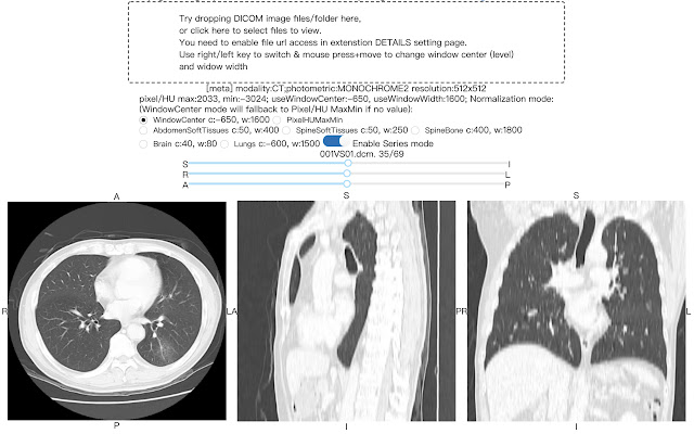 DICOM image viewer from Chrome web store to be run with OffiDocs Chromium online DICOM image viewer from Chrome web store to be run with OffiDocs Chromium online