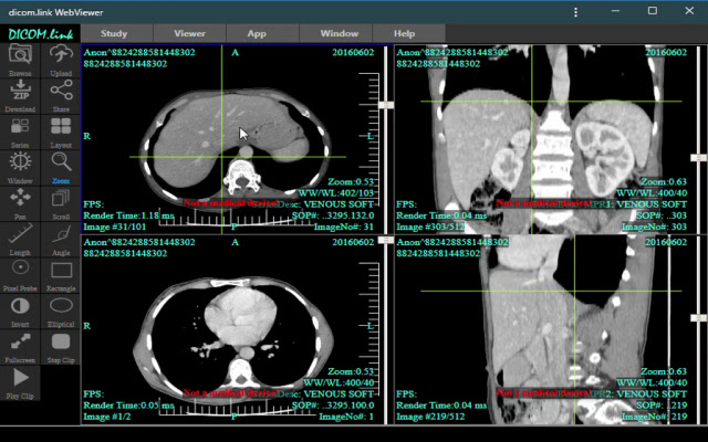 dicom.link Dicom Viewer from Chrome web store to be run with OffiDocs Chromium online dicom.link Dicom Viewer from Chrome web store to be run with OffiDocs Chromium online