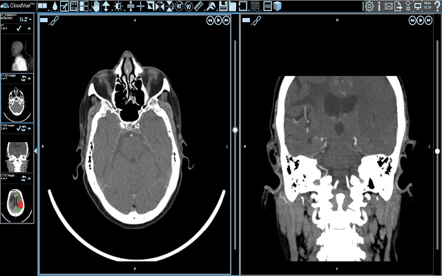 IMS Multimonitor Extension from Chrome web store to be run with OffiDocs Chromium online IMS Multimonitor Extension from Chrome web store to be run with OffiDocs Chromium online